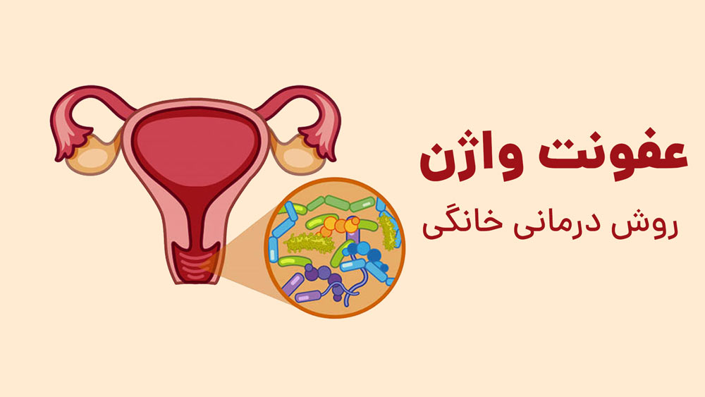 روغن نارگیل برای عفونت واژن + روش درمانی خانگی